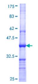 SDS-PAGE (CARM1-0402H).jpg